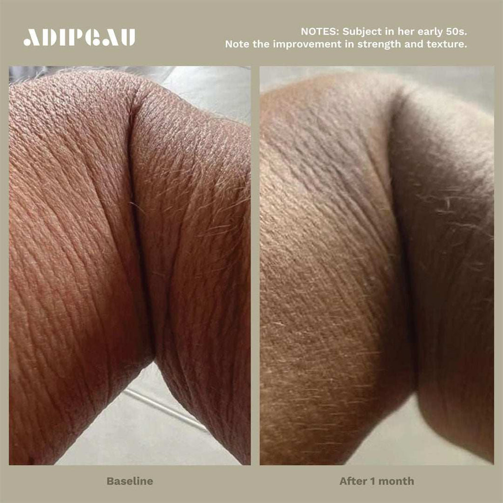 Strength Gel tube with collagen-boosting benefits for firmer skin and cellulite reduction