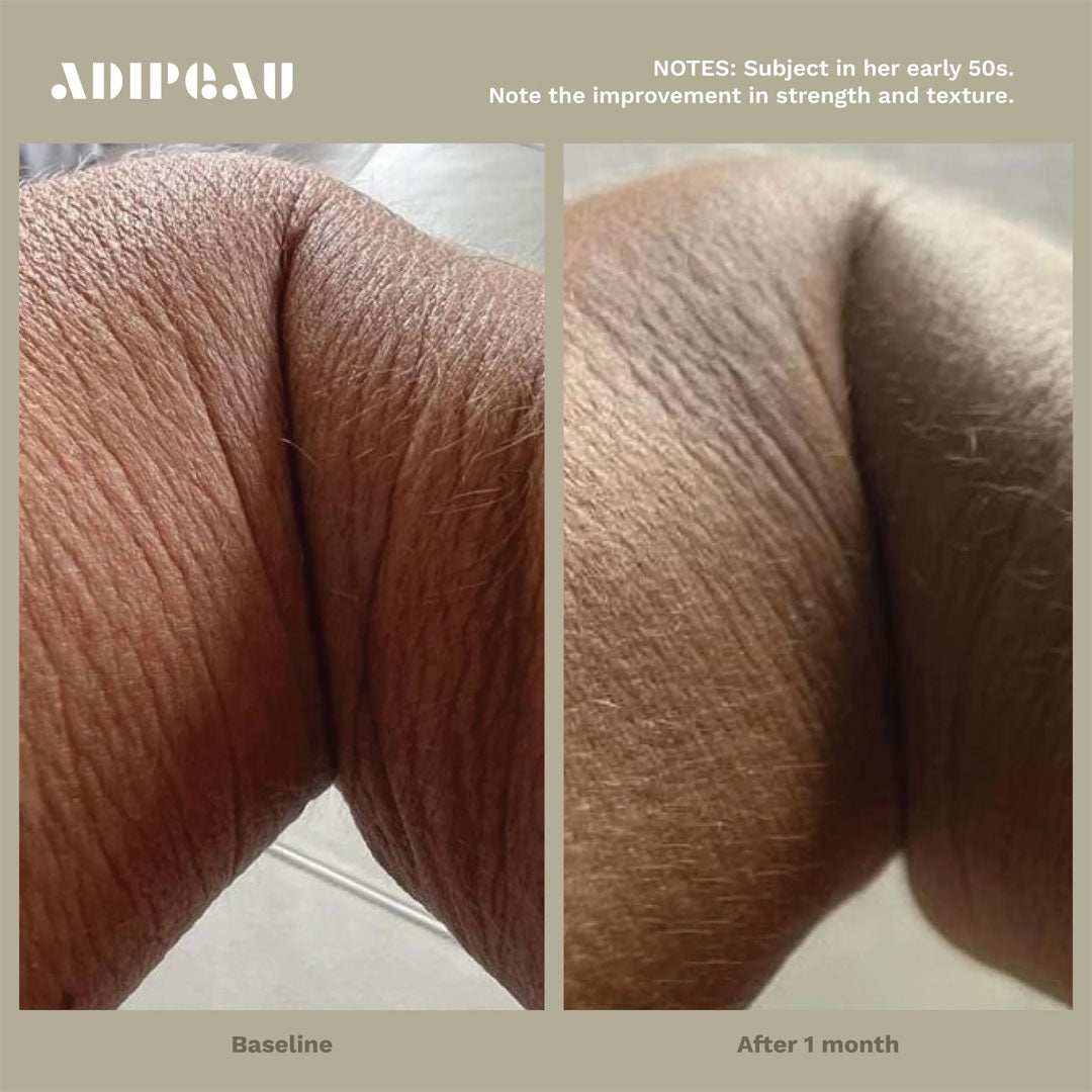 Strength Gel tube with collagen-boosting benefits for firmer skin and cellulite reduction