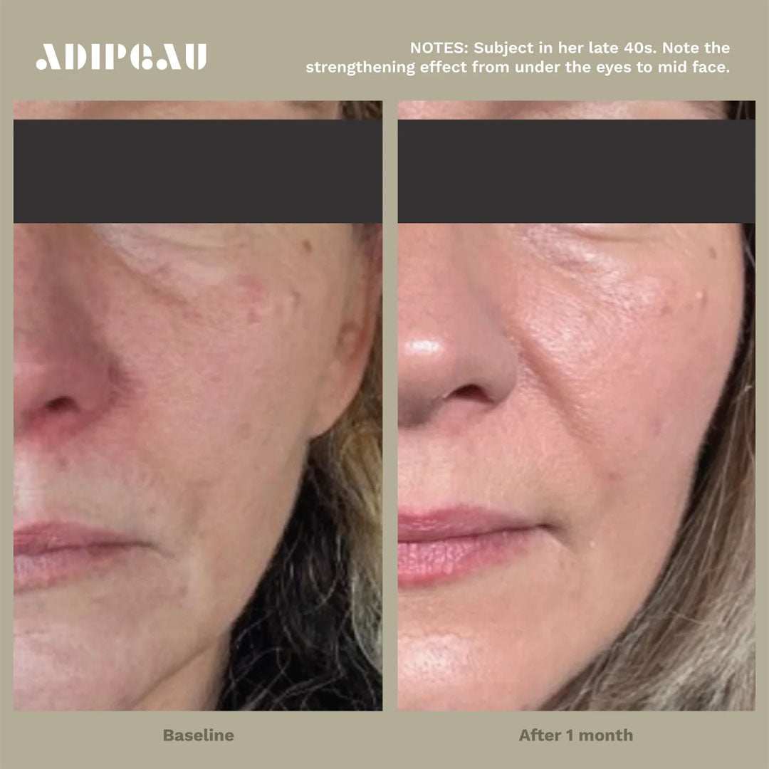 Strength Gel tube beside smooth skin illustrating collagen and cellulite reduction benefits