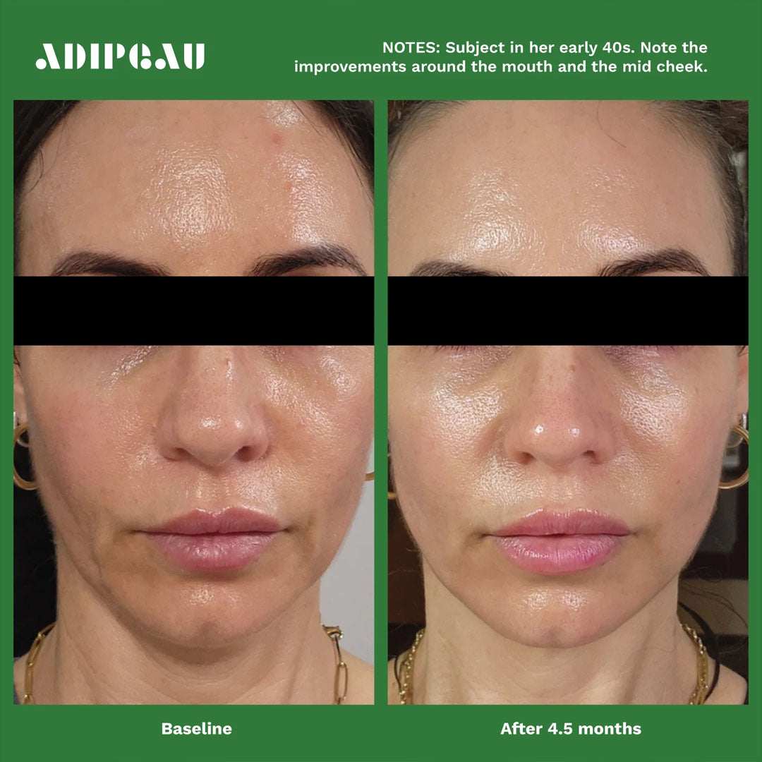 Volume Cream jar highlighting natural ingredients for dermal fat cell regeneration and facial fat fitness.