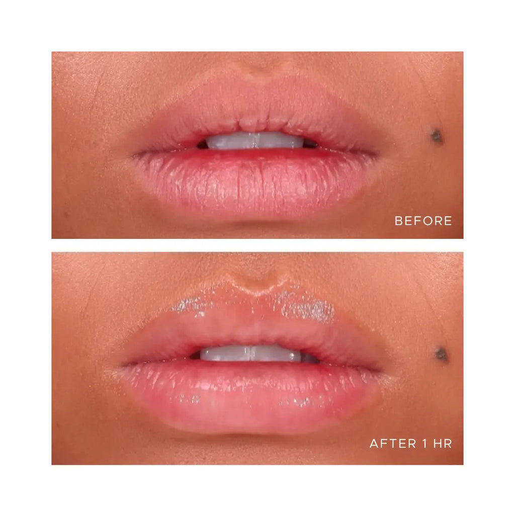 ÂN-GLOSS Ceramide Lip Treatment-Lip Balms & Treatments-ANFISA-Leigh Kelley Skin Studio Best Facialist Hudson Valley Kingston New York