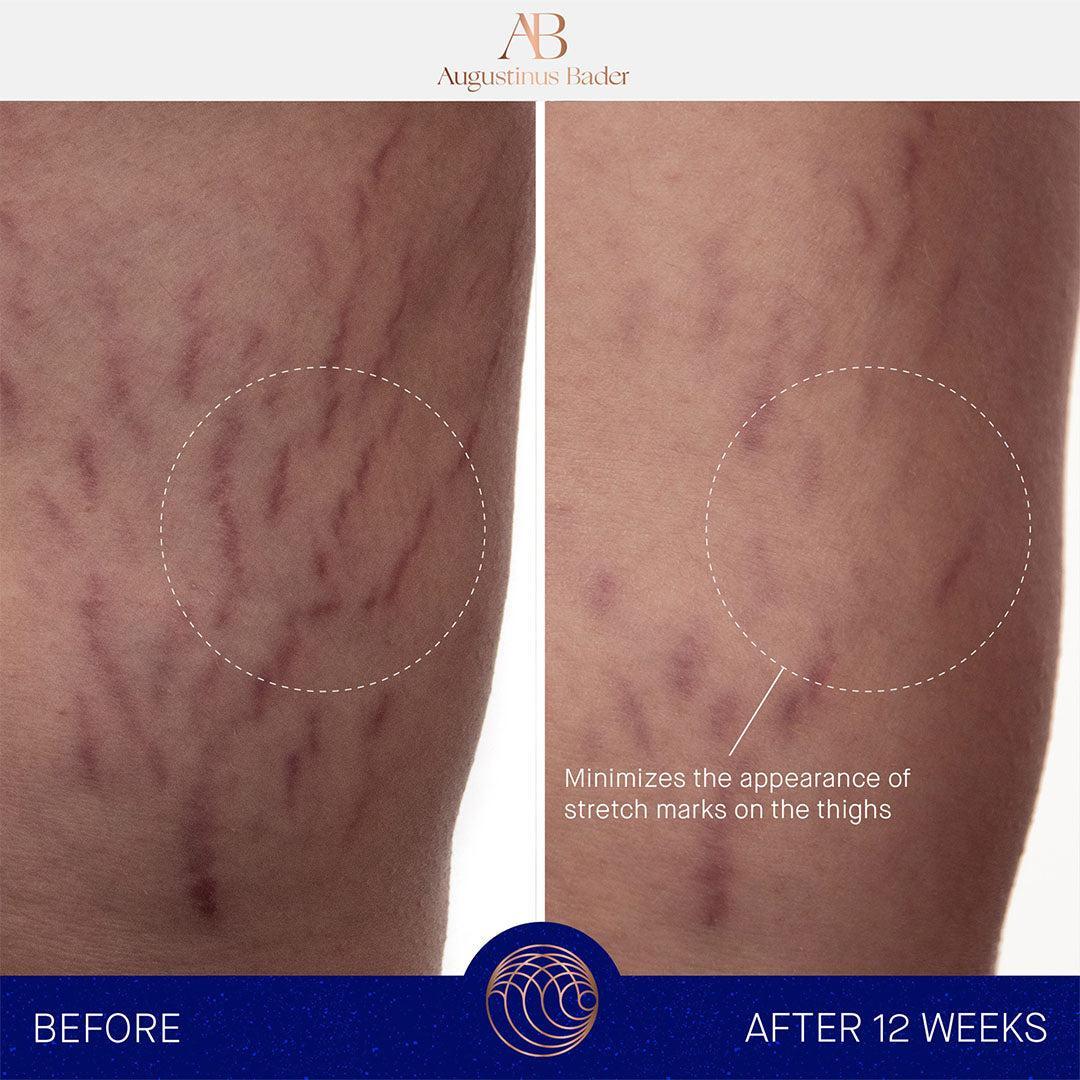 Augustinus Bader The Body Cream-Body Care-Augustinus Bader-Leigh Kelley Skin Studio Best Facialist Hudson Valley Kingston New York
