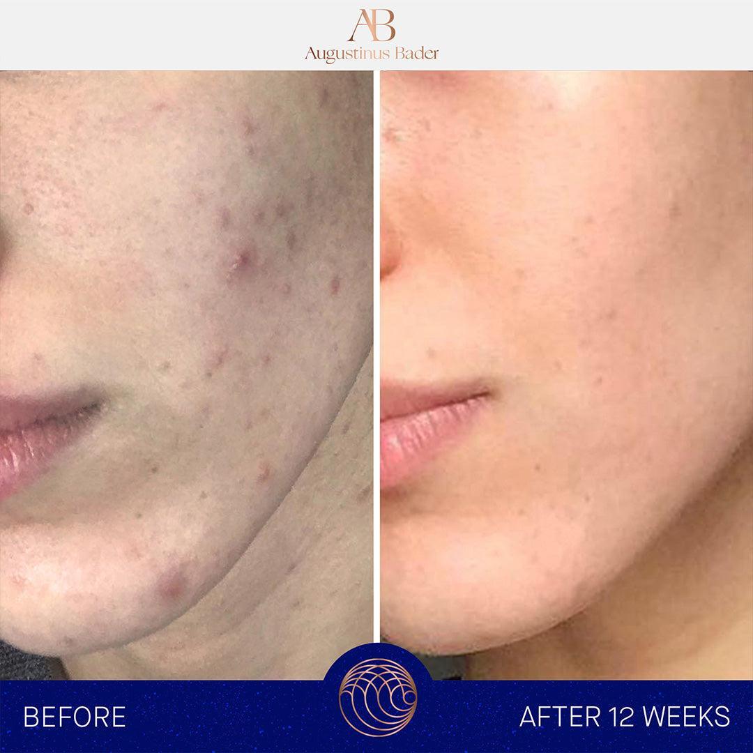 Augustinus Bader The Cream-Lotion & Moisturizer-Augustinus Bader-Leigh Kelley Skin Studio Best Facialist Hudson Valley Kingston New York
