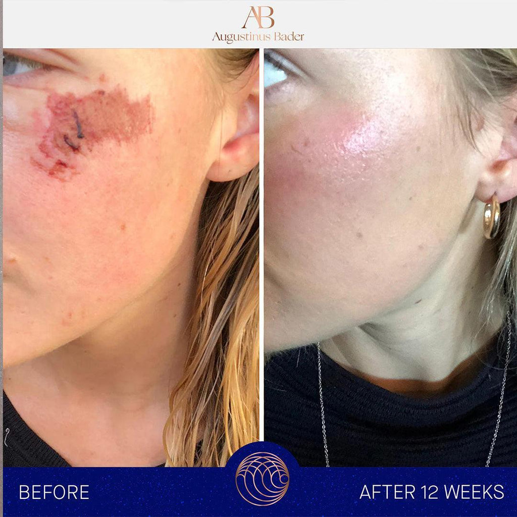 Augustinus Bader The Cream-Lotion & Moisturizer-Augustinus Bader-Leigh Kelley Skin Studio Best Facialist Hudson Valley Kingston New York