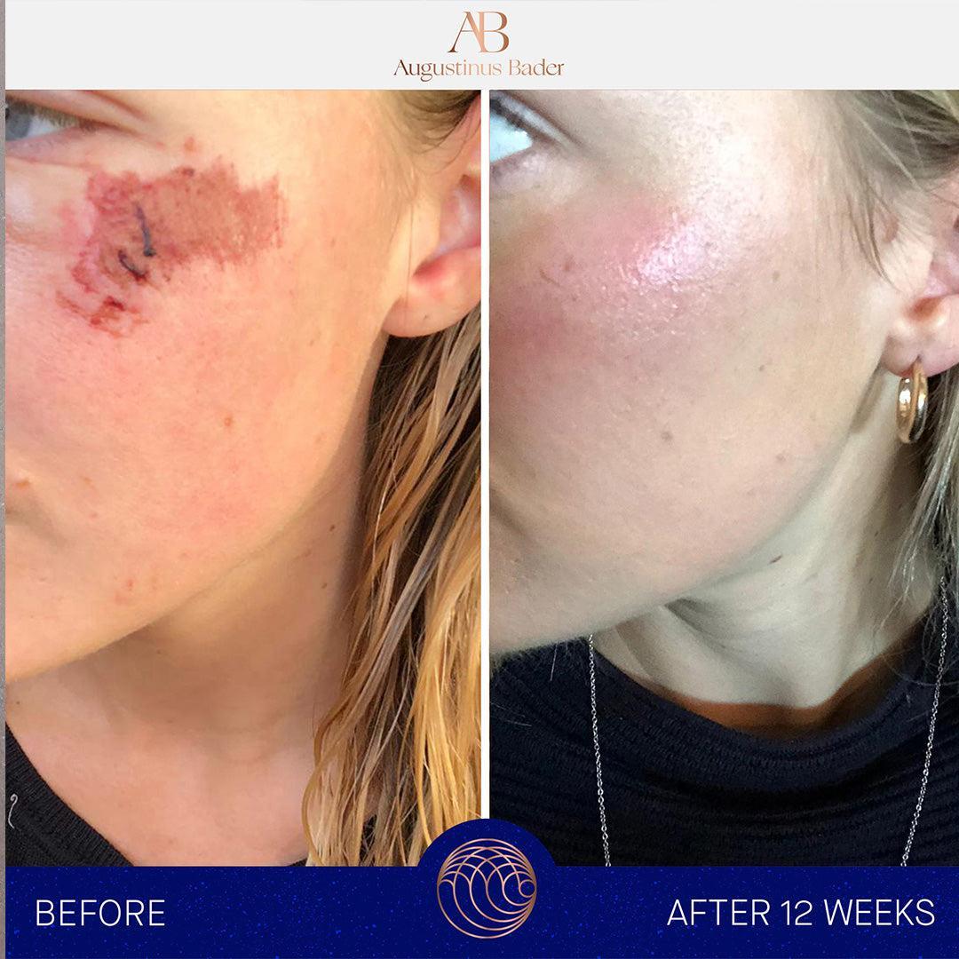 Augustinus Bader The Cream-Lotion & Moisturizer-Augustinus Bader-Leigh Kelley Skin Studio Best Facialist Hudson Valley Kingston New York