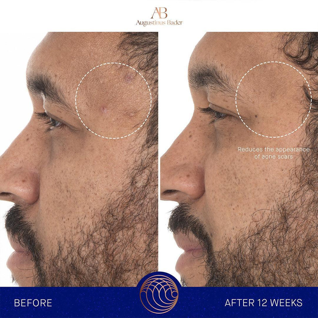 Augustinus Bader The Retinol Serum-Serum-Augustinus Bader-Leigh Kelley Skin Studio Best Facialist Hudson Valley Kingston New York