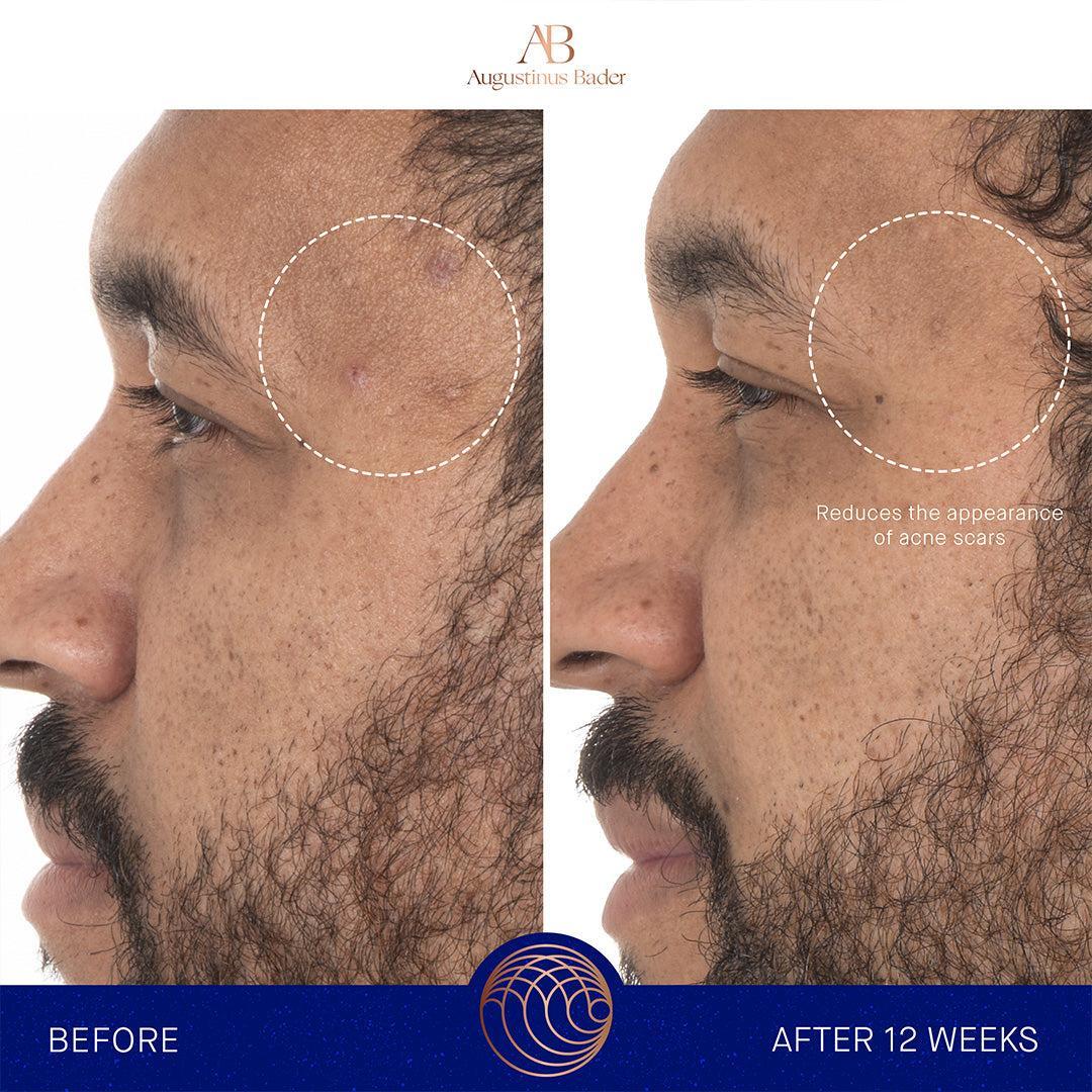 Augustinus Bader The Retinol Serum-Serum-Augustinus Bader-Leigh Kelley Skin Studio Best Facialist Hudson Valley Kingston New York