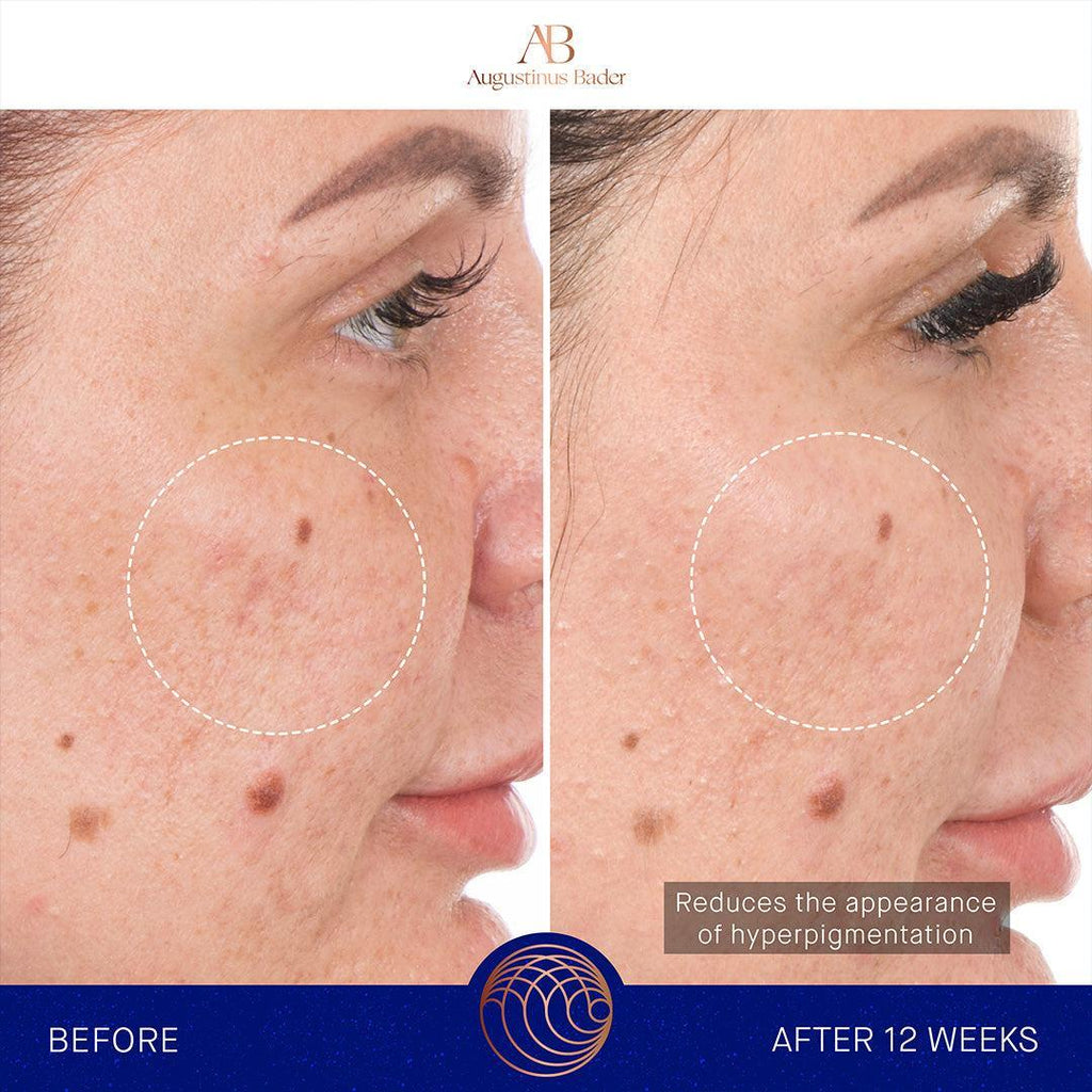 Augustinus Bader The Retinol Serum-Serum-Augustinus Bader-Leigh Kelley Skin Studio Best Facialist Hudson Valley Kingston New York