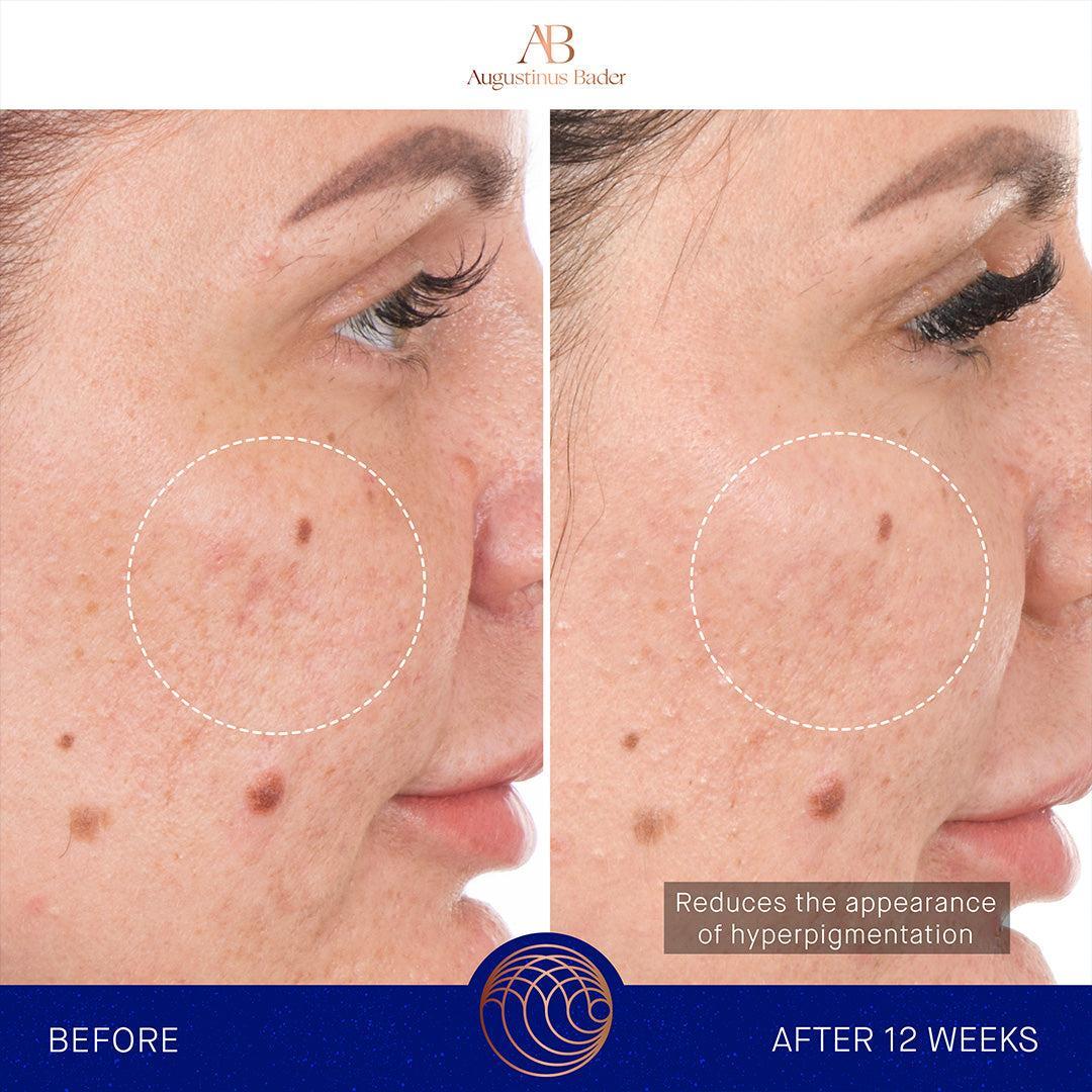Augustinus Bader The Retinol Serum-Serum-Augustinus Bader-Leigh Kelley Skin Studio Best Facialist Hudson Valley Kingston New York