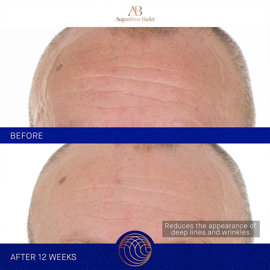 Augustinus Bader The Retinol Serum-Serum-Augustinus Bader-Leigh Kelley Skin Studio Best Facialist Hudson Valley Kingston New York