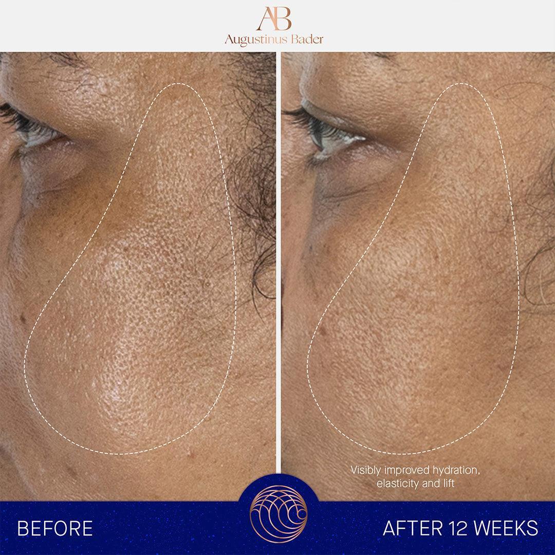 Augustinus Bader The Serum-Serum-Augustinus Bader-Leigh Kelley Skin Studio Best Facialist Hudson Valley Kingston New York