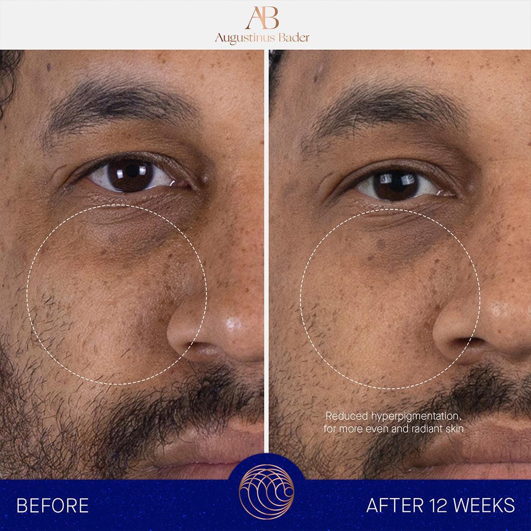 Augustinus Bader The Serum-Serum-Augustinus Bader-Leigh Kelley Skin Studio Best Facialist Hudson Valley Kingston New York