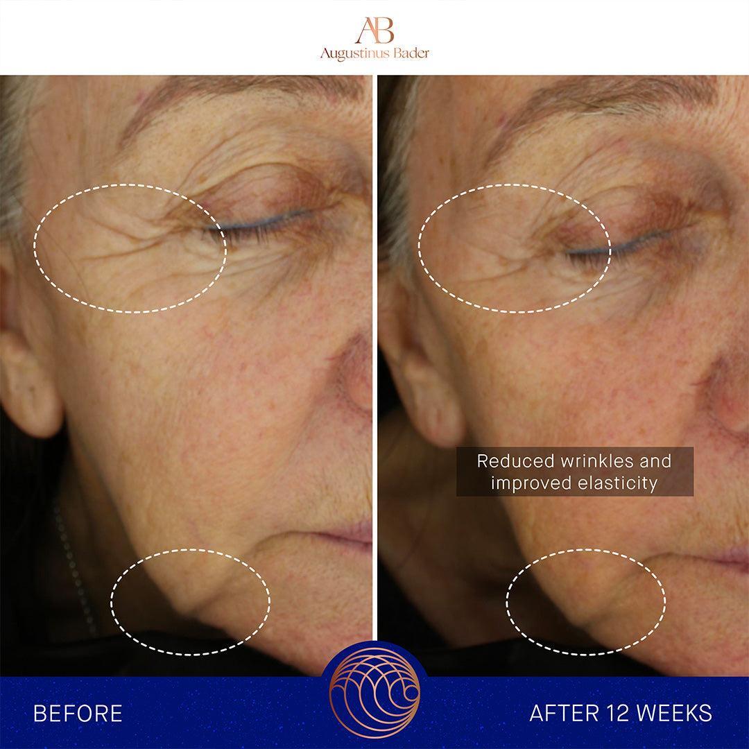 Augustinus Bader The Ultimate Soothing Cream-Lotion & Moisturizer-Augustinus Bader-Leigh Kelley Skin Studio Best Facialist Hudson Valley Kingston New York