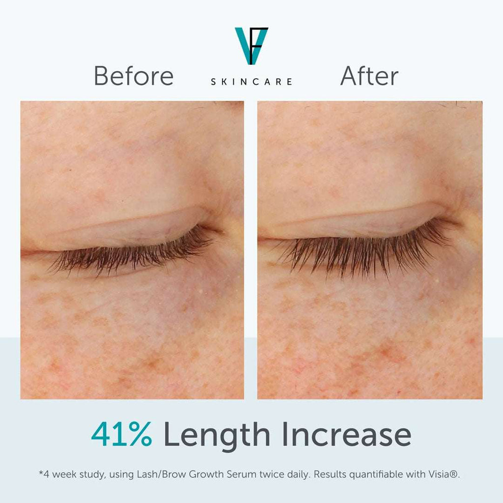 Lash and Brow Growth Serum bottle with natural ingredients for thicker lashes and brows