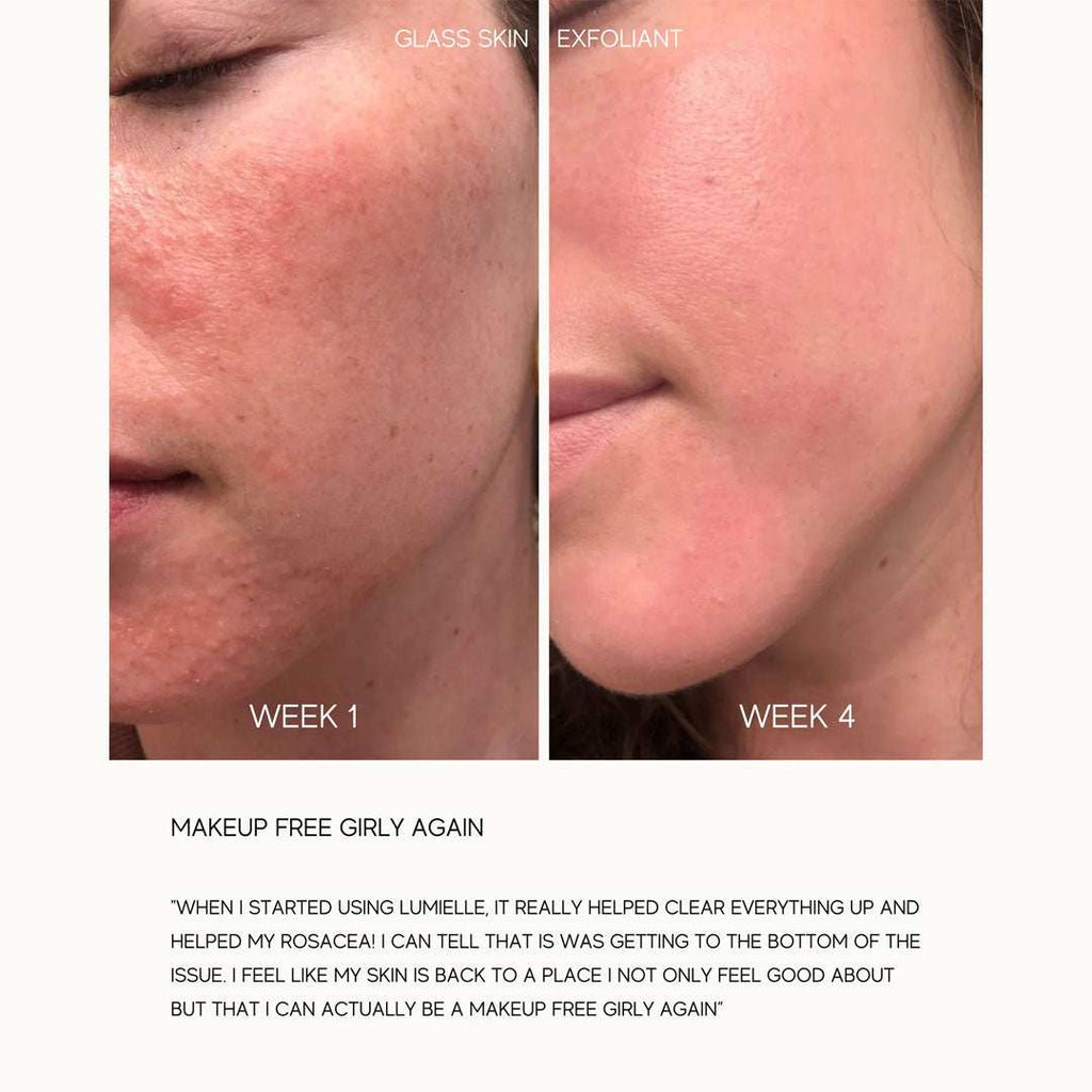 Bottle of Glass Skin Liquid Exfoliant with clear liquid for gentle skin exfoliation and smoothing
