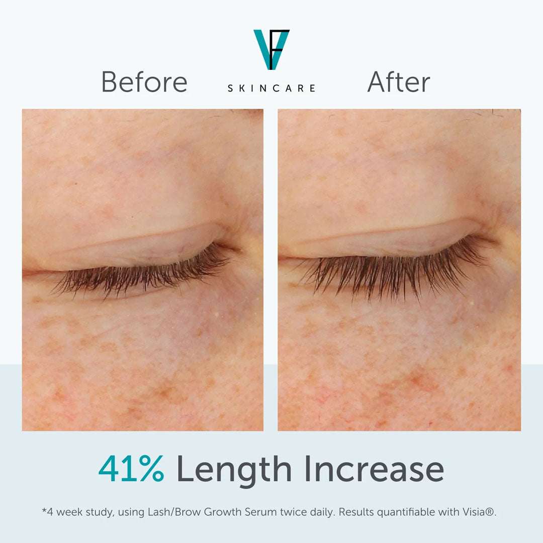 Lash and Brow Growth Serum bottle with natural ingredients for thicker lashes and brows