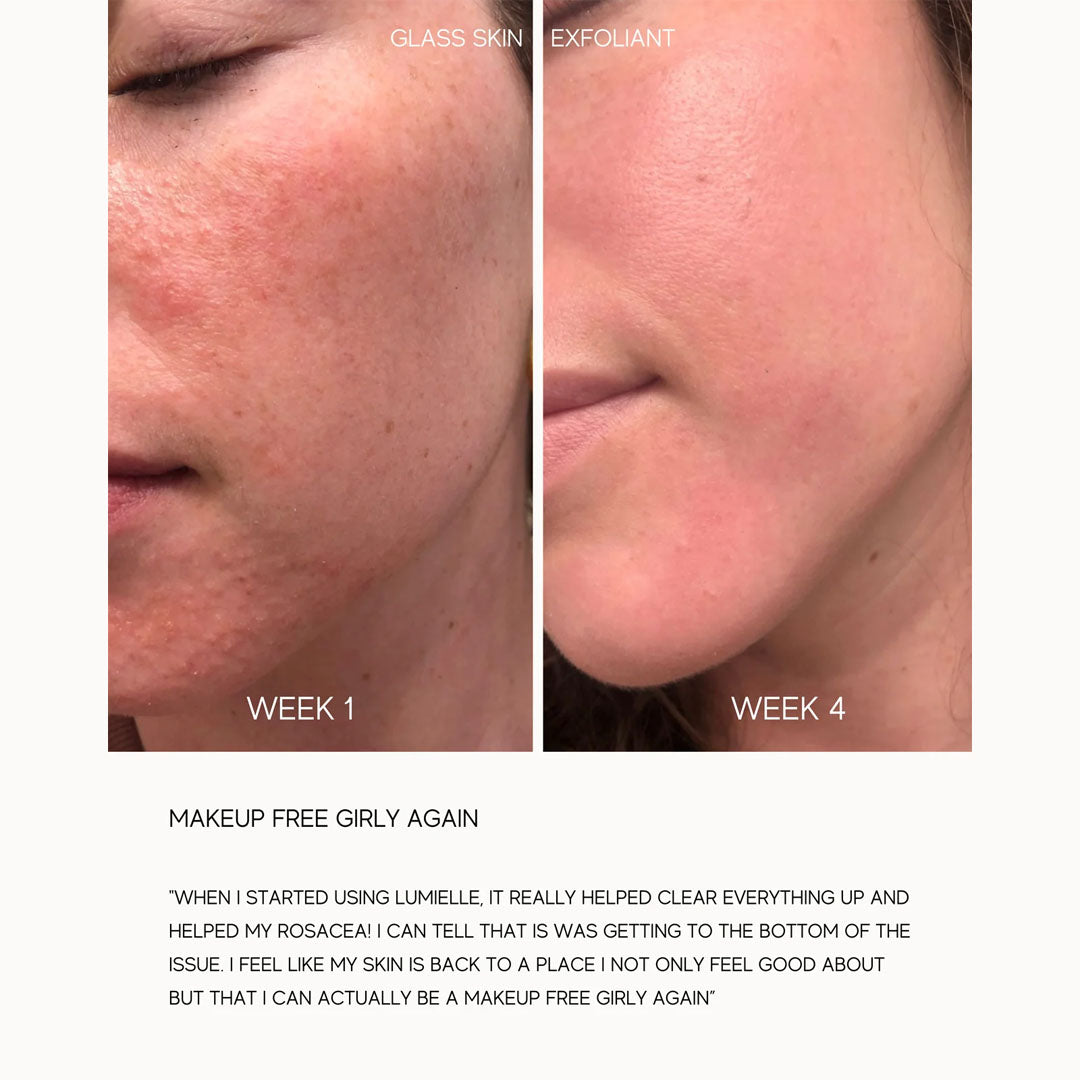 Lumiellé Glass Skin Liquid Exfoliant-Toners & Astringents-Lumiellé-Leigh Kelley Skin Studio