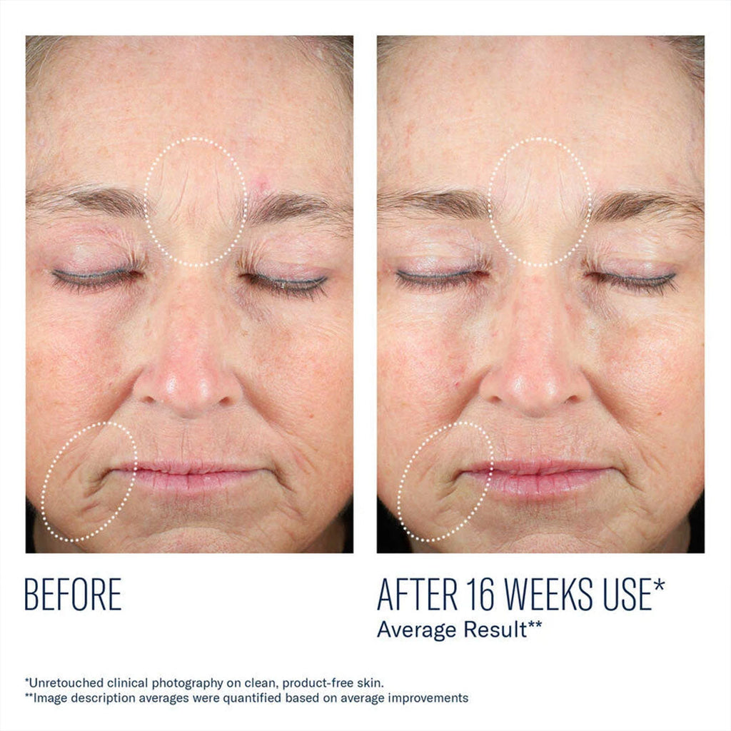 Mystro Revive Renewing Serum-Targeted Treatments-SkinBetter-Skin Design MA