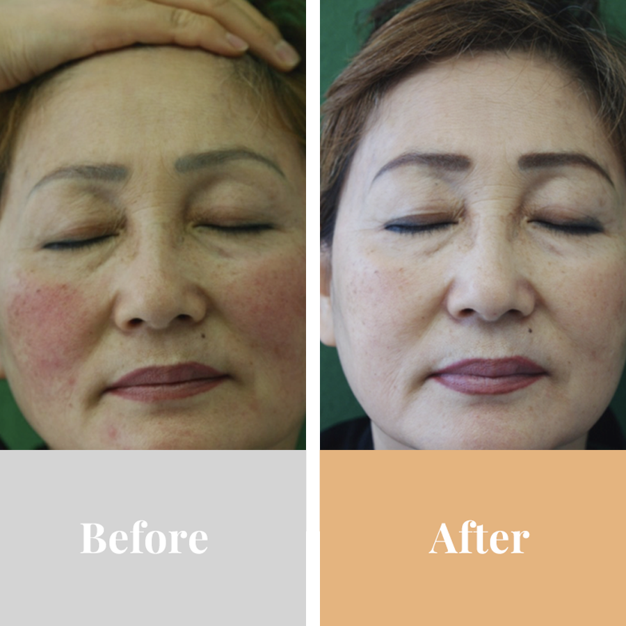 Omnilux Contour Face-Skin Care Tools-Omnilux-Leigh Kelley Skin Studio Best Facialist Hudson Valley Kingston New York