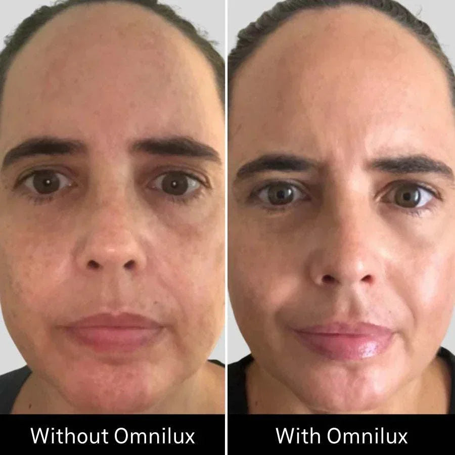 OmniluxOmnilux Contour FaceTools