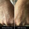 Omnilux Contour Glove-Skin Care Tools-Omnilux-Leigh Kelley Skin Studio Best Facialist Hudson Valley Kingston New York
