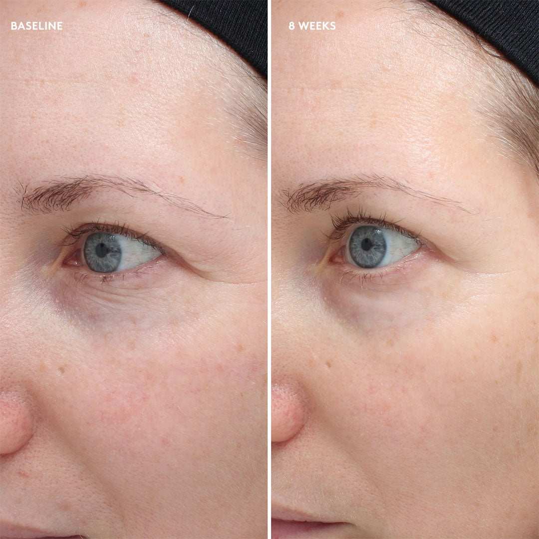 Total Eye® Firm & Repair Cream jar with key ingredients for brightening and firming under-eye skin