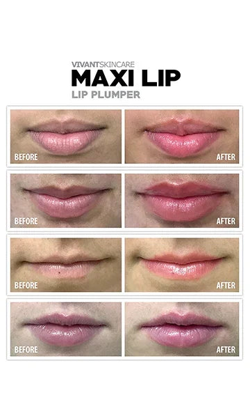 Vivant Maxilip Lip Plumper