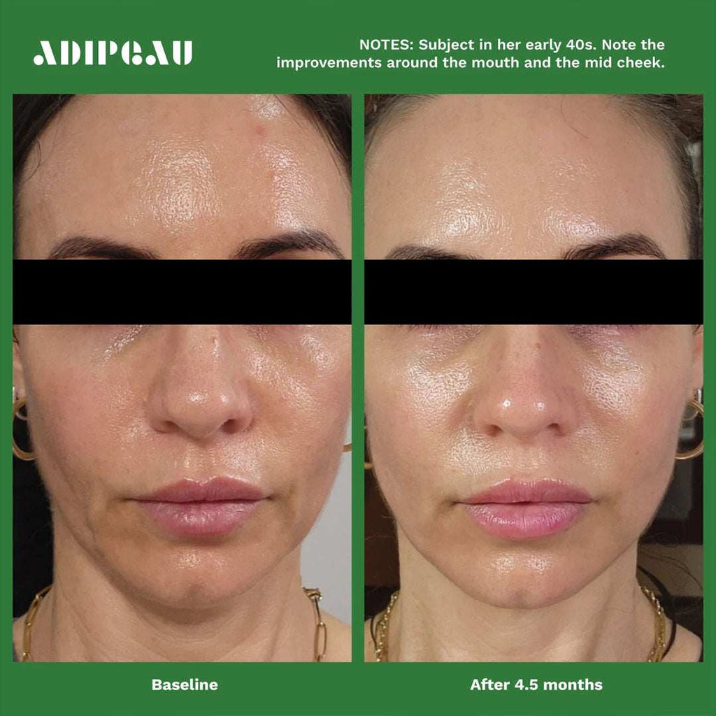 Volume Cream jar highlighting natural ingredients for dermal fat cell regeneration and facial fat fitness.